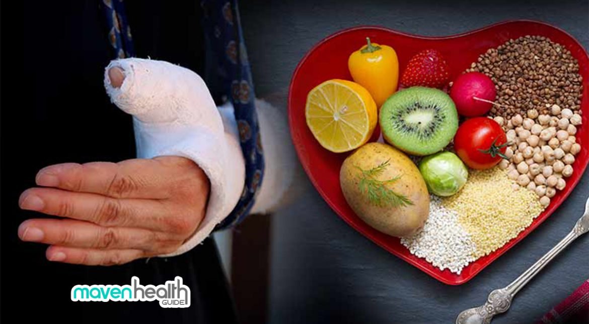 Foods That Help Heal Broken Bones Faster