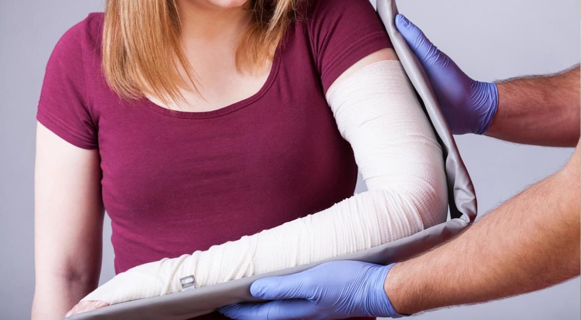 Tips for Faster Fracture Healing; Common types and Healing