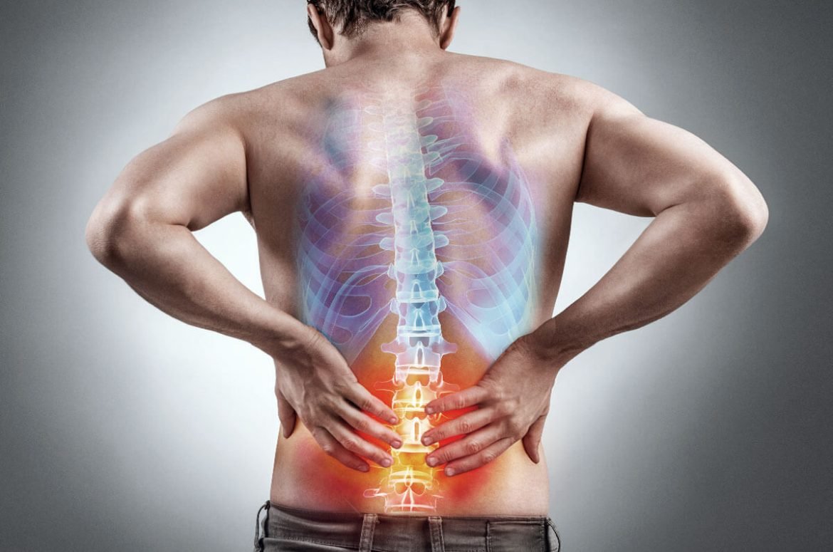 natural remedies for back pain and inflammation