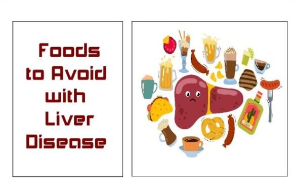 foods-to-avoid-with-liver-disease